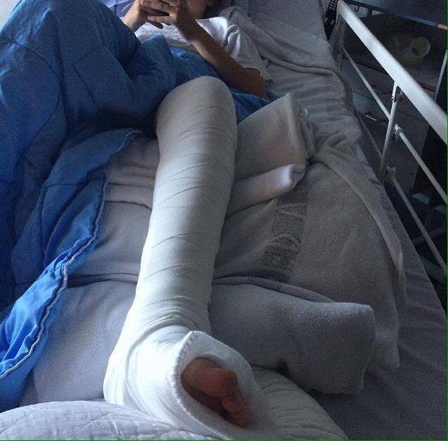 Tonser TOBY, broken leg. Foto: unknown, Credits coming